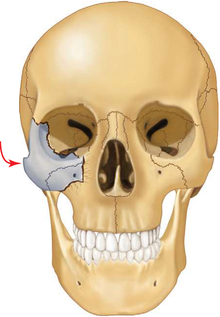 FIGURE 16-13 Anatomic areas for determining the proper reduction of ZMC fracture. A, Rotation of the ZMC in the vertical axis is most easily determined by its alignment with the greater wing of the sphenoid along the internal orbit (straight arrow). B, The zygomaticomaxillary buttress provides a sensitive indicator of malar projection.