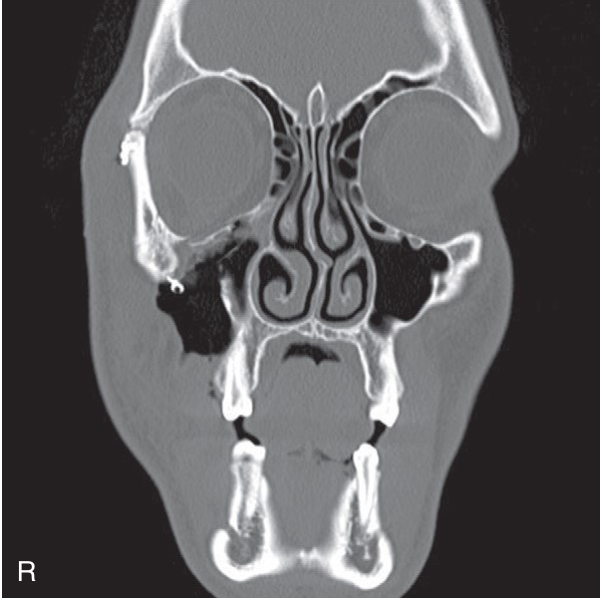 FIGURE 16-16, cont’d