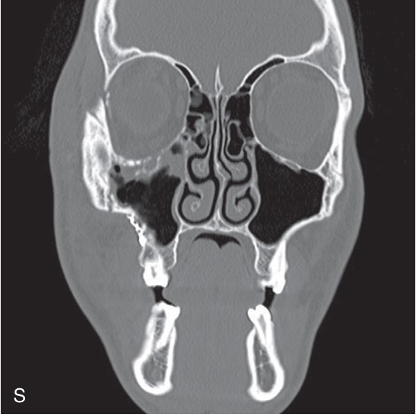 FIGURE 16-16, cont’d